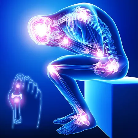 หักข้อต่อ ก๊อบแก๊บ ส่อโรคกระดูกเสื่อม