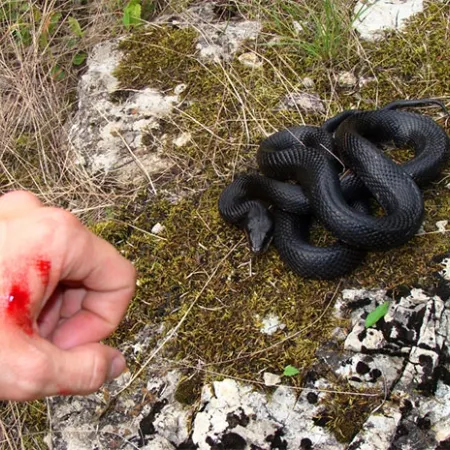 ปฐมพยาบาลเบื้องต้นผู้ป่วยถูกงูกัด