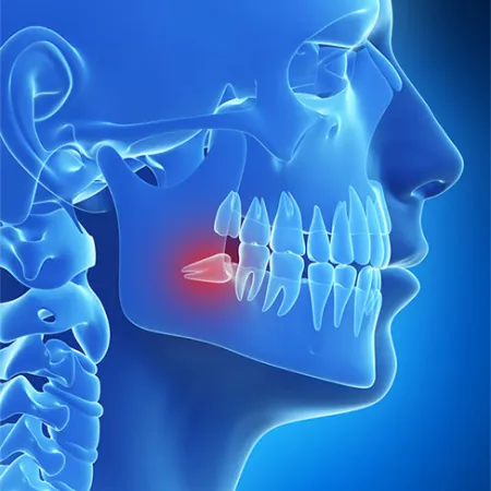 ฟันหลุด ออกมาจากกระดูกเบ้ารากฟัน