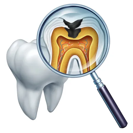 วัสดุอุดฟัน