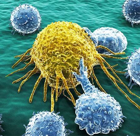 ยารักษาเบาหวานเมทฟอร์มิน ป้องกันมะเร็งได้