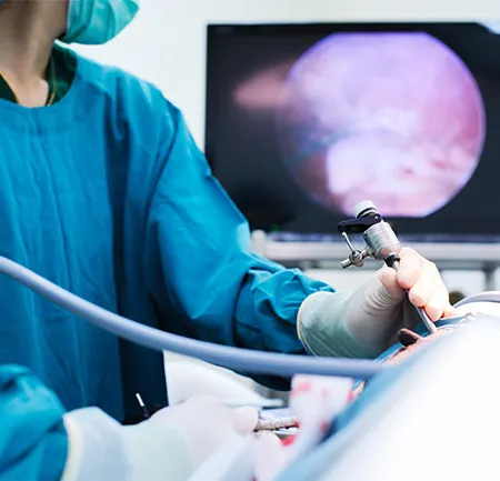 การผ่าตัดผ่านกล้อง