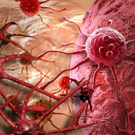 รังสีรักษา ฉายรังสี รักษามะเร็ง