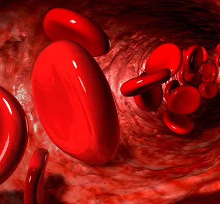 ภาวะซีด โลหิตจาง