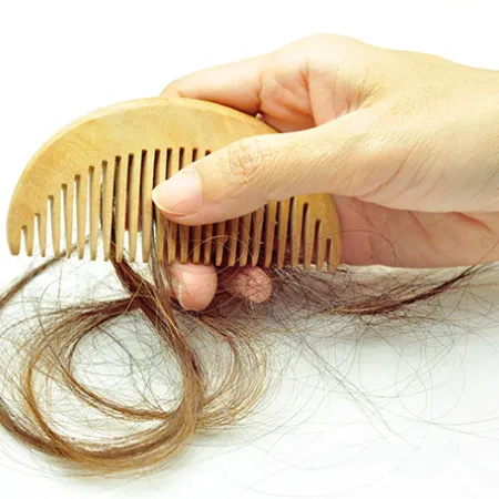 8 วิธีบอกลาผมร่วง