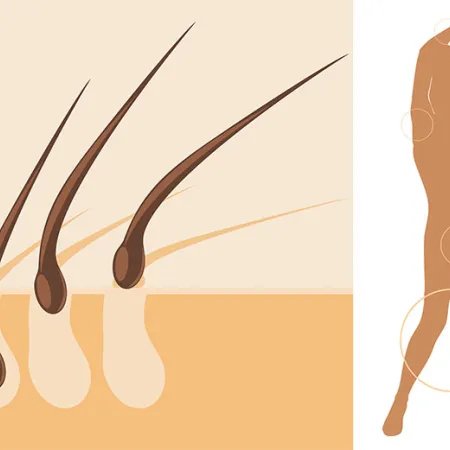 6 วิธีกำจัดขนให้ปลอดภัยทุกส่วนของร่างกาย