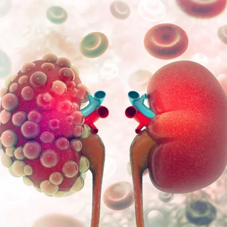 เบาหวานความดันเลือดสูงไขมันในเลือดสูงน่ากลัวตรงไหน