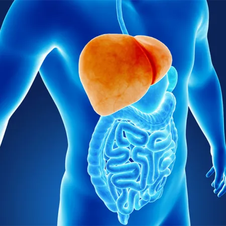 ดัชนีมวลกายสูงเสี่ยงโรคตับ