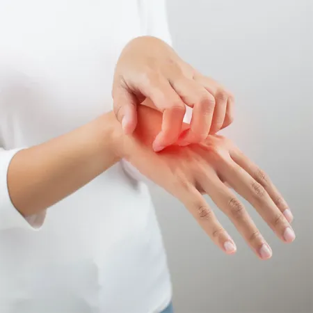 ผื่นมีกี่ชนิดมีผื่นอะไรบ้าง